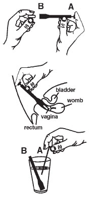 Clotrimazole Vaginal Insert USP