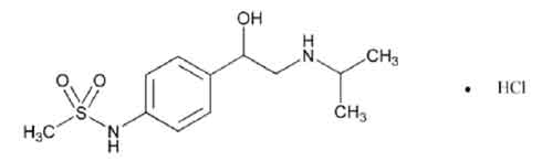 Sotalol Hydrochloride Tablets USP 